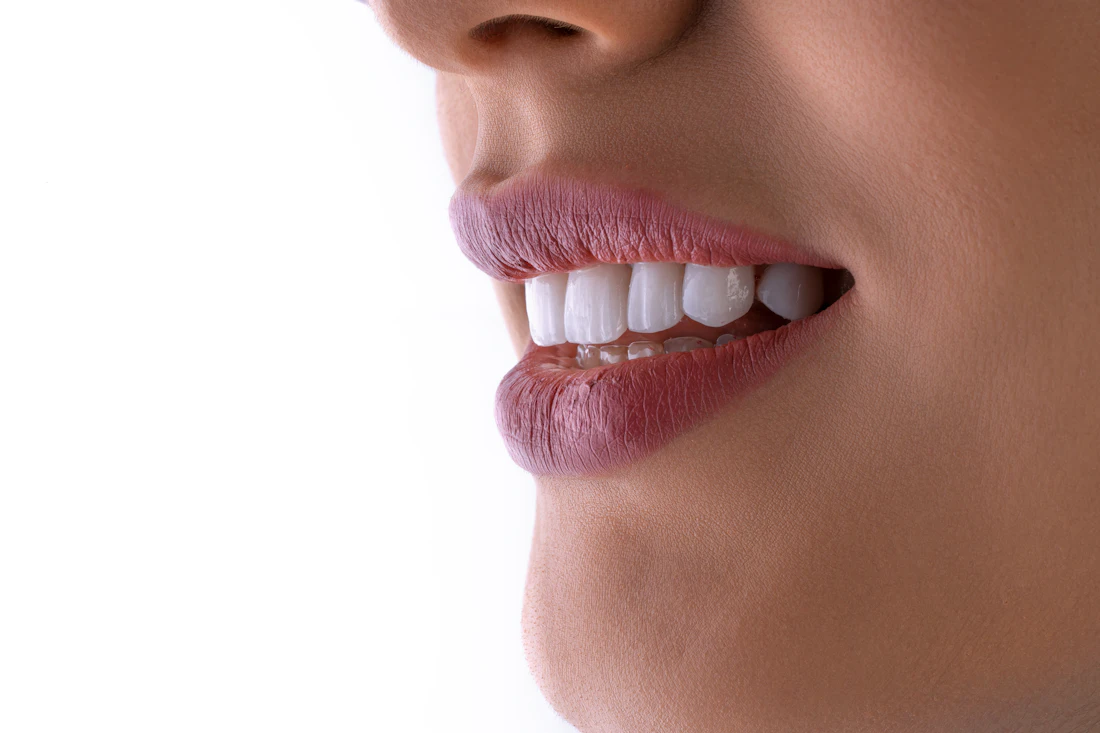 Perfil de sorriso com dentes claros